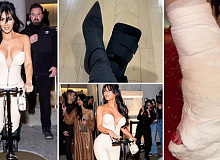 kim-kardashijan-na-skrshenoto-stapalo-si-stavi-gips-so-oblik-na-visoka-potpetica-crveni-nokti-01.jpg