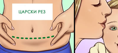 9-raboti-koi-treba-da-gi-znaete-za-carskiot-rez-iskustva-od-majki-povekje.jpg