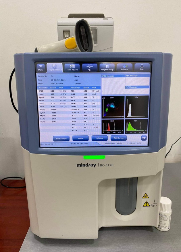 nova-donacija-za-19-godishninata-na-adora-inzhenering-avtomatski-hematoloshki-analizator-koj-kje-napravi-presvrt-vo-hematologijata-vo-zdravstveniot-dom-vo-radovish-02.jpg