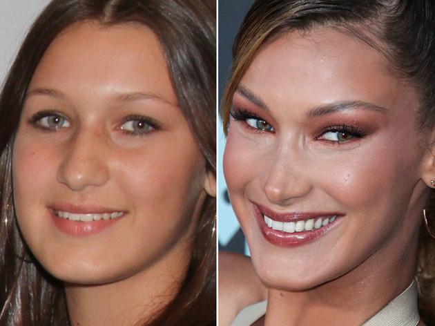 bella-hadid-before-and-after-3.jpg