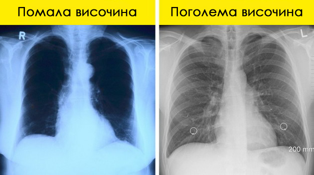 slabeenjeto-e-pobrzo-vodata-vrie-na-poniska-temperatura-kako-se-menuva-zhivotot-na-pogolema-nadmorska-visochina-04.jpg