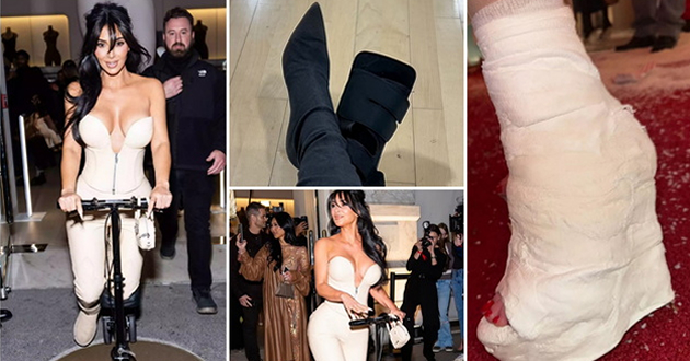 kim-kardashijan-na-skrshenoto-stapalo-si-stavi-gips-so-oblik-na-visoka-potpetica-crveni-nokti-01.jpg