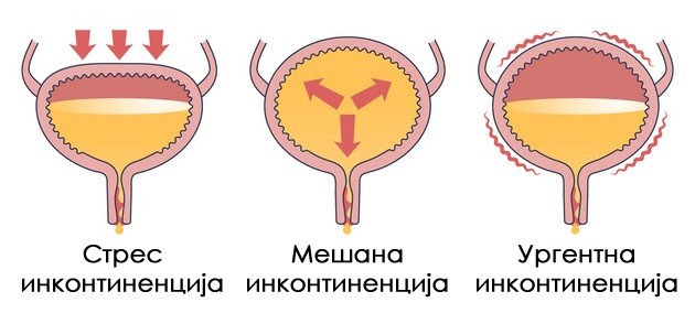 prof-d-r-vasil-iliev-so-chesto-praznenje-na-mochniot-meur-se-namaluva-negoviot-kapacitet-02.jpg